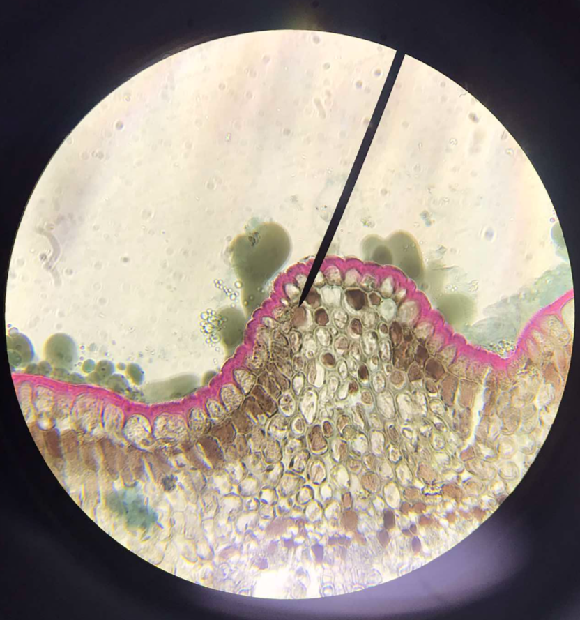<p><span>dermal tissue; the outermost cell layer of the plant body; two types: uniseriate and multiseriate</span></p>