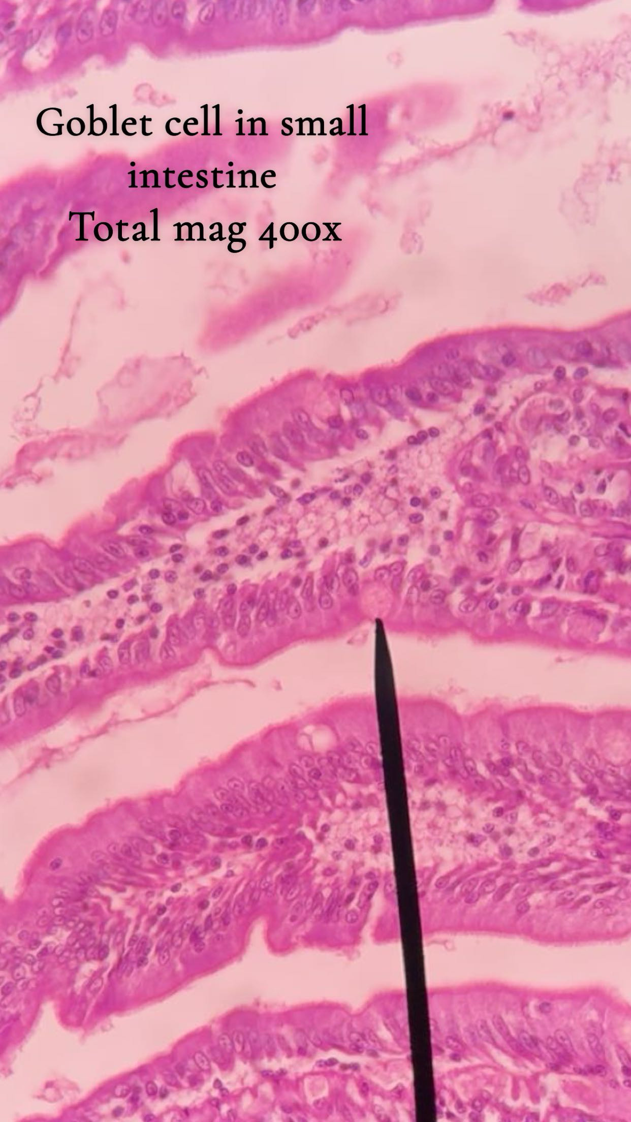 term image