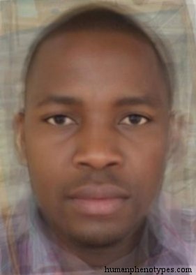 <p>Identify this Phenotype</p>