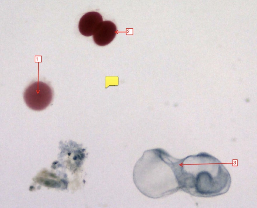 <p>starfish development stages- (3) </p>