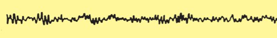 Associated with a relaxed, calm, internally focused wakeful state of consciousness, especially if eyes are closed

* Medium to high frequency, low amplitude