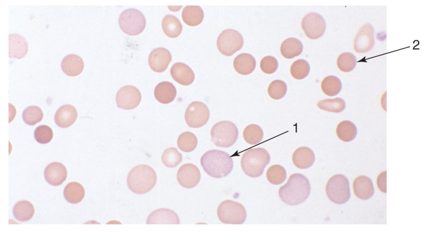 <p>what are polychromatophilic RBCs (reticulocytes)?</p>