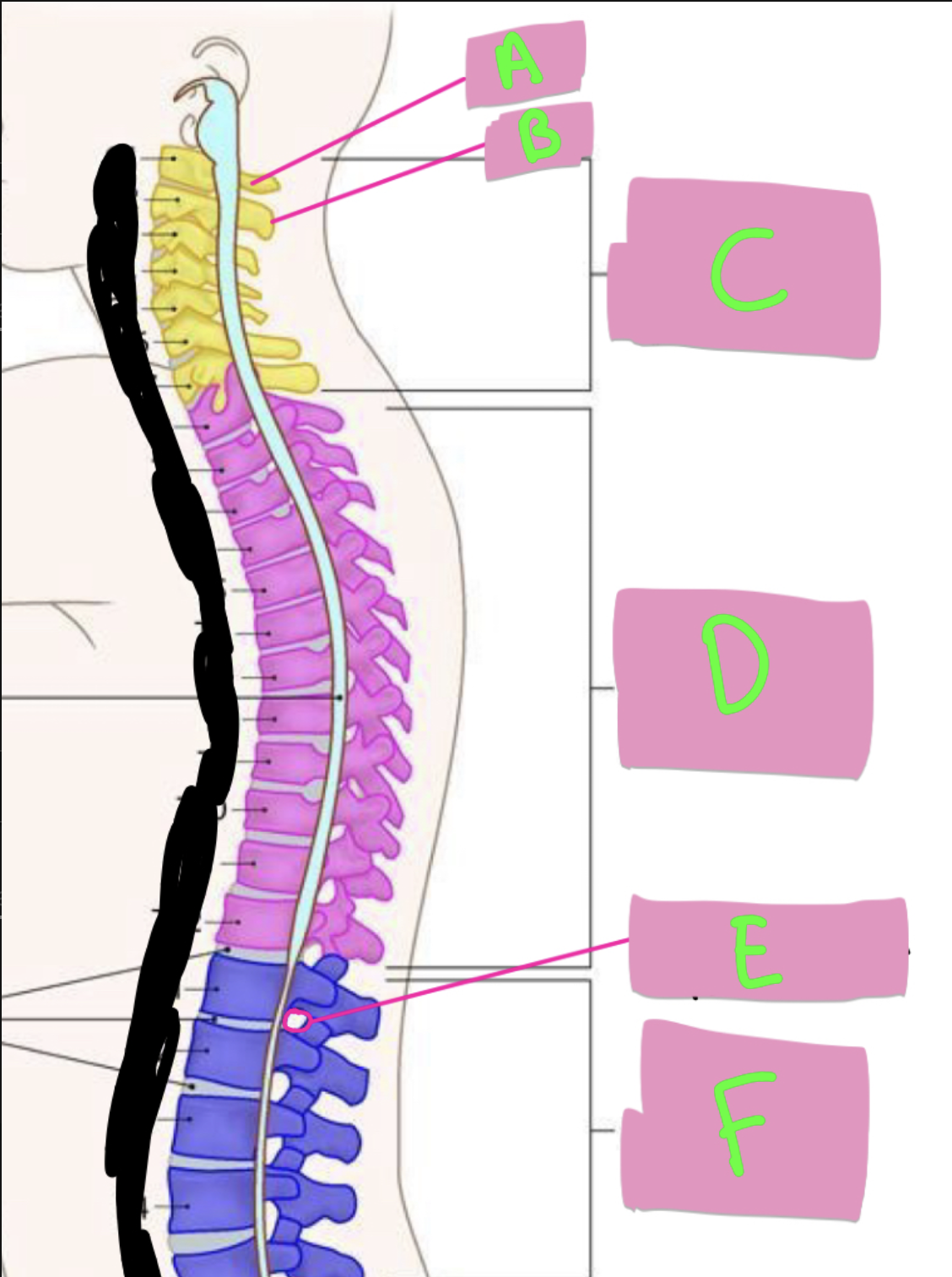 <p>What’s E-H? </p>