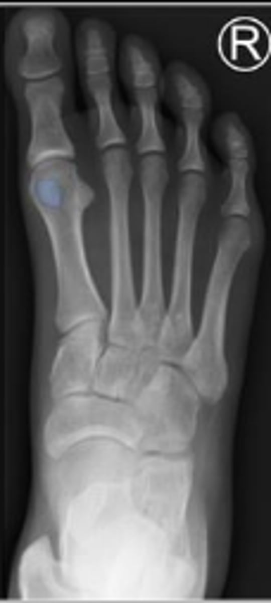 <p>What is outlined?</p>