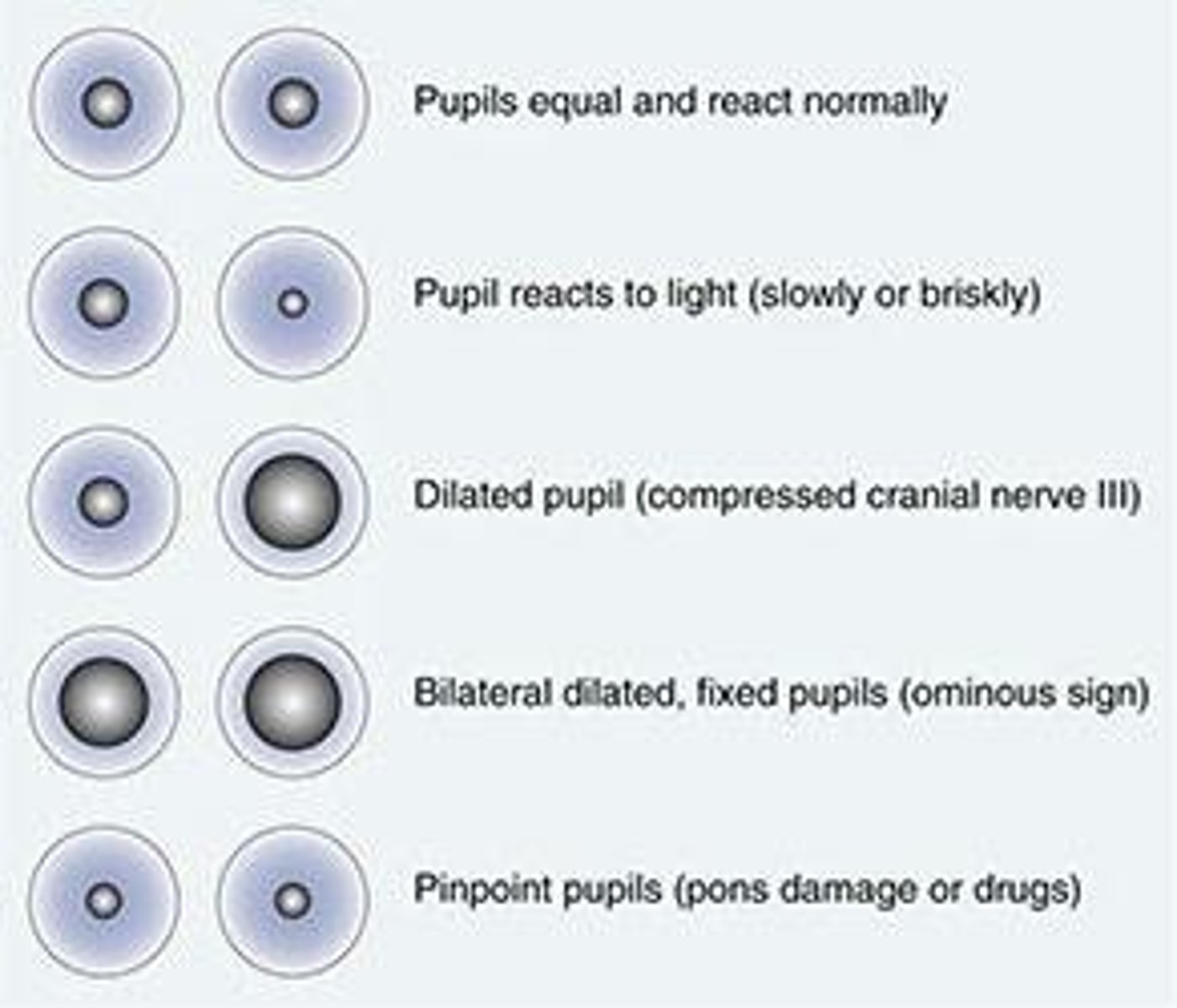 <p>pupils are equal, round, and reactive to light and accommodation</p>