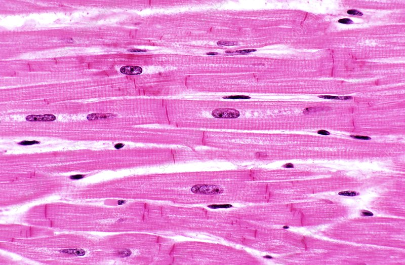 <p>Cardiac Muscle Tissue — Location</p>