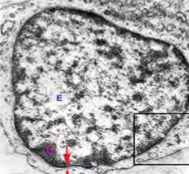 <p>What kind of electron microscope produces this image?</p>