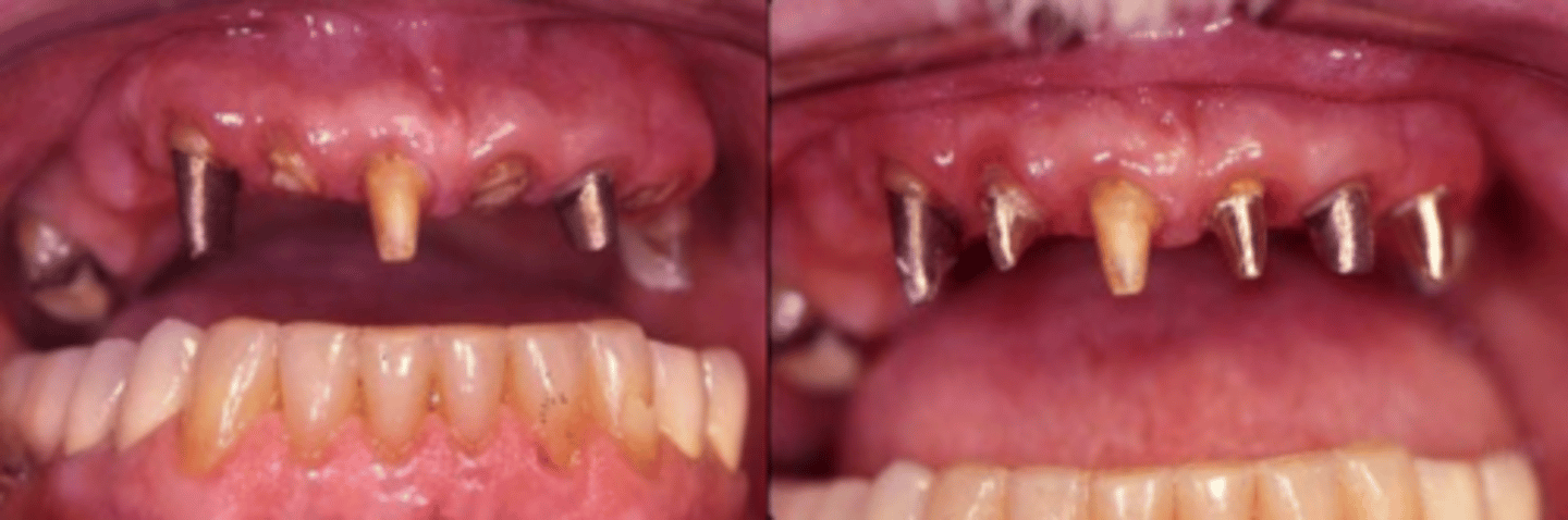 <p>What treatment do you suspect happened here?</p>