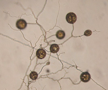 <p>which fungi group is this? is it chytrids, rhizopus stolonifer, or arbuscular mychorrizae, sac fungi, or club fungi?</p>