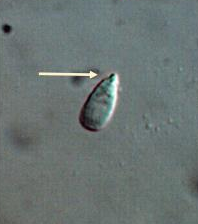 <p>Identify the sperm morphology.</p>