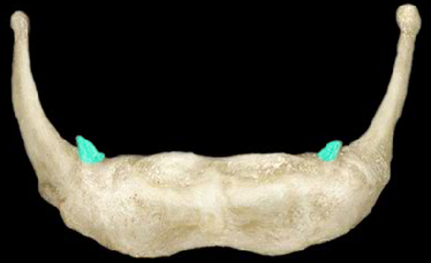 <p>horn-shaped extension of bone</p>