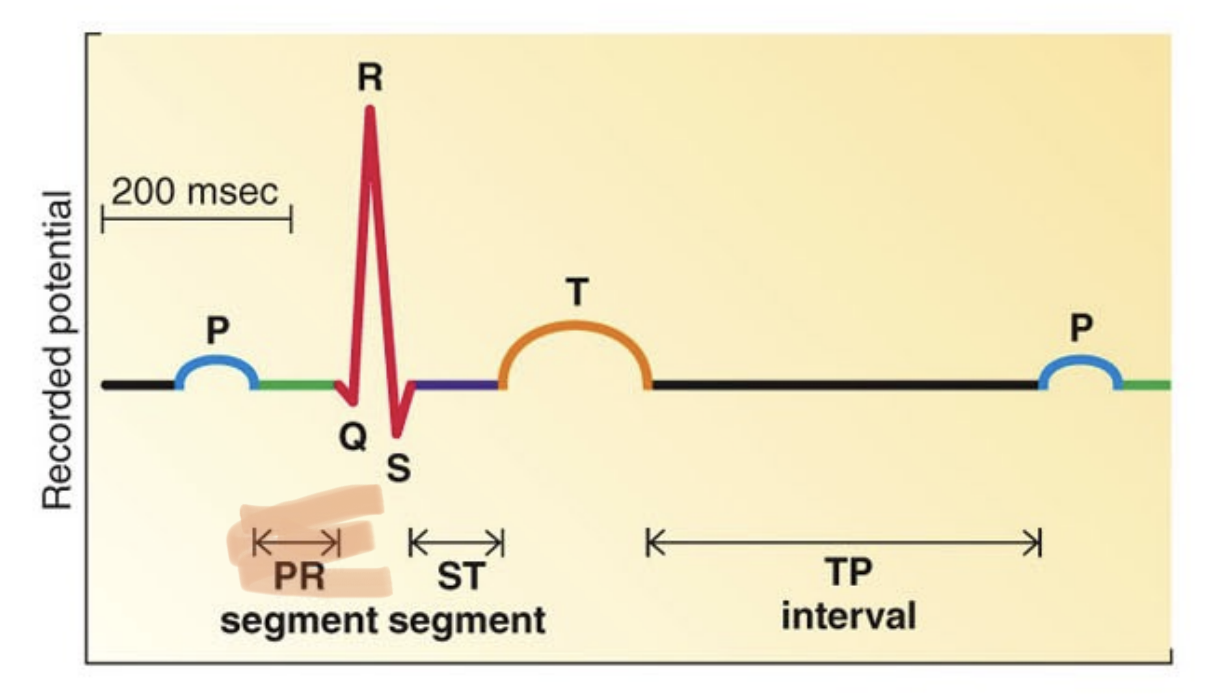 <p>A. Time from the start of atrial depolarization to the start of ventricular depolarization</p>