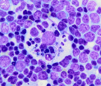 <p>lymph node morphological features</p><p>What is this?</p>