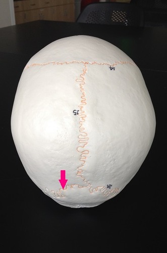 <p>Identify the suture.</p>