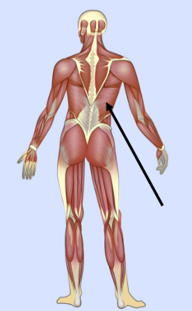 <p>What major muscle is this?</p>