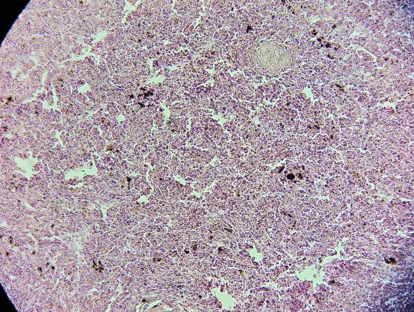 <p><span data-name="microscope" data-type="emoji">🔬</span><span data-name="petri_dish" data-type="emoji">🧫</span><strong><span> </span>Na podstawie zdjęcia preparatu:</strong></p><p></p><ul><li><p><span data-name="book" data-type="emoji">📖</span><span> </span>rozpoznaj gatunek pasożyta;</p></li></ul><p></p><ul><li><p><span data-name="recycle" data-type="emoji">♻</span><span> </span>rozpoznaj wszystkie formy rozwojowe;</p></li></ul><p></p><ul><li><p><span data-name="microbe" data-type="emoji">🦠</span><span> </span>wskaż organelle i cechy charakterystyczne dla danego gatunku;</p></li></ul><p></p><ul><li><p><span data-name="mask" data-type="emoji">😷</span><span> </span>nazwij chorobę, którą pasożyt wywołuje.</p></li></ul><p></p>