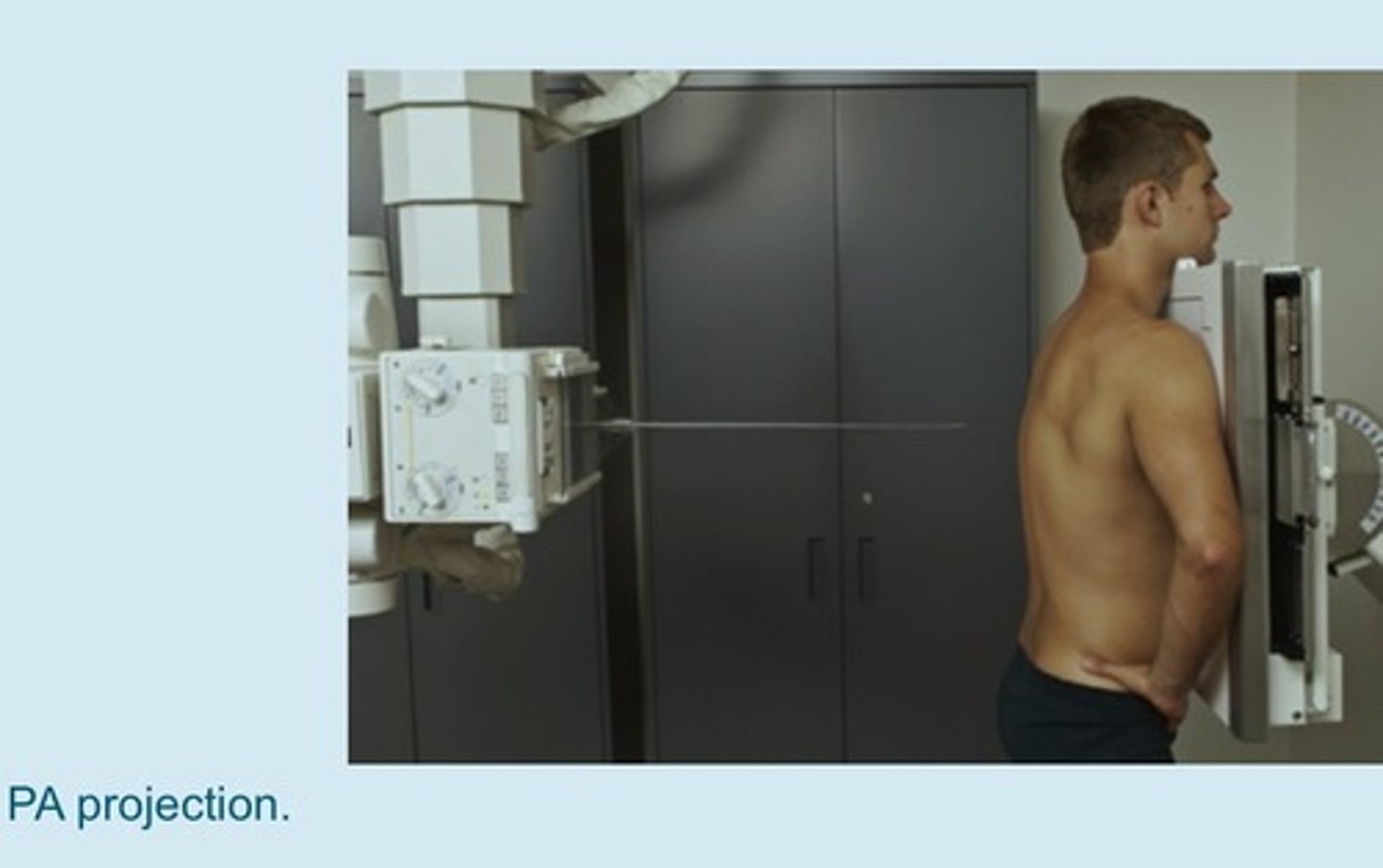 <p>patient faces the cassette</p><p>- done in radiology department</p><p>- beam passes "posterior-to-anterior"</p>
