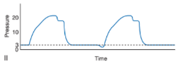 <ul><li><p><span>II shows that when PEEP is being applied it is expected that pressure never returns to baseline, but rather remains at this preset level above atmospheric pressure between breaths (dashed line)</span></p><ul><li><p><span>Pressure decreases below this preset level indicate either patient effort, artifact, or circuit leaks</span></p></li></ul></li></ul><p></p>