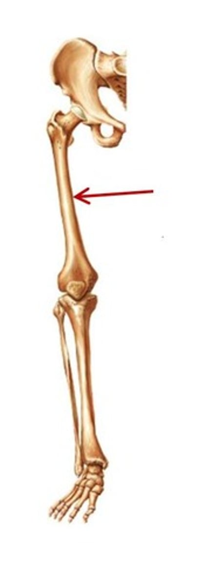 <p>ID bone</p>
