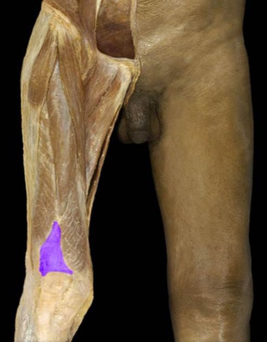 <p>Name this connective tissue structure.</p>