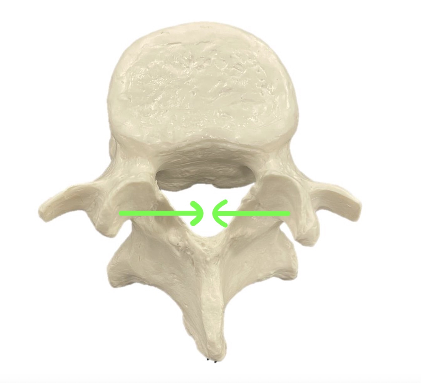 <p>What Bone Is This If The Facets Are Facing Inwards?</p>