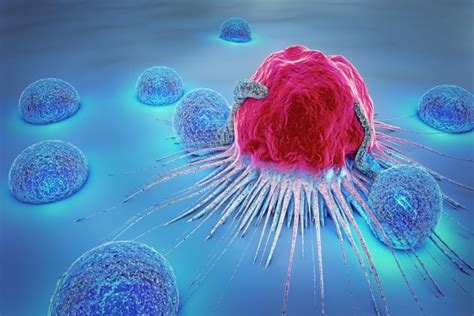 <p>tumor</p>