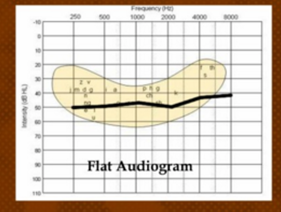 <p>hearing loss starts and stops in the same range</p>