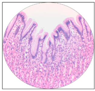 <p>What is this the histology of?</p>