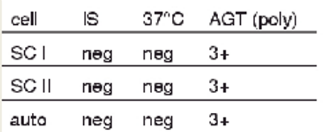 <p>antibody screen results + possible interpretations</p><ul><li><p>3+ at AHG for SCI, SCII, and with autocontrol</p></li></ul><p></p>