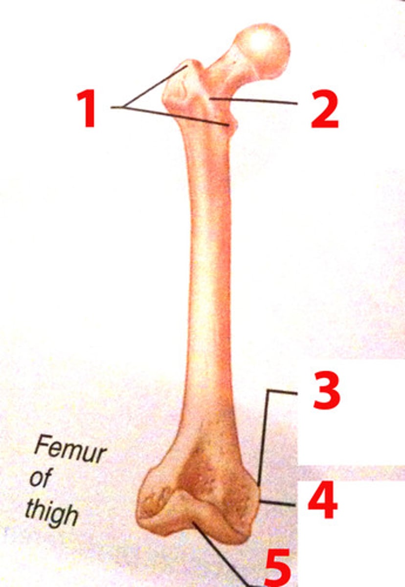 <p>anterior ridge between greater and lesser trochanters</p><p>o Continues posteriorly and inferior as spiral line (2)</p>
