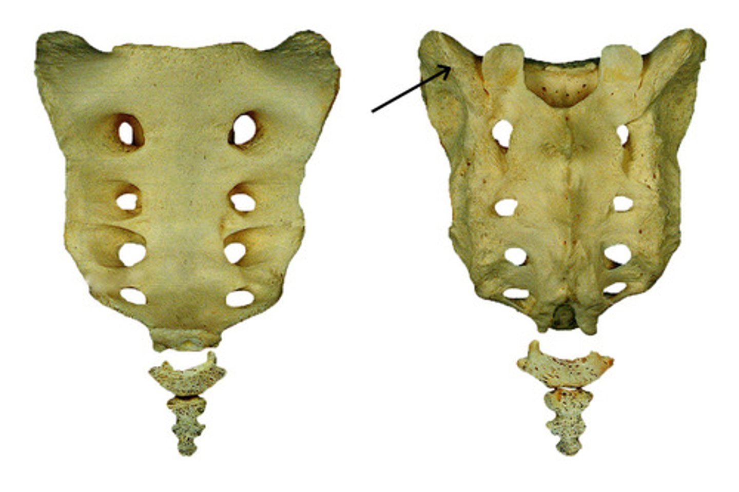<p>- roughened surface immediately posterior to the auricular surface</p><p>- attachment site for sacroiliac ligaments</p>