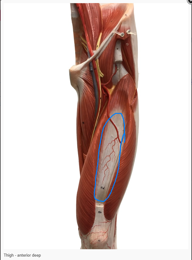 <p>What is the name of the muscle circled&nbsp;</p>
