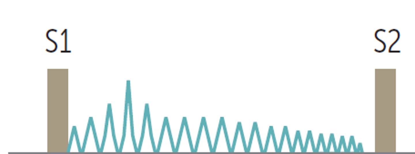 <p>SYSTOLIC</p><p>-Crescendo-decrescendo</p><p>-Loudest at heart base</p><p>-Radiates to carotids</p><p>-"Pulsus parvus et tardus": weak pulses with delayed peak</p><p>-Complications: *S*yncope, *A*ngina, *D*yspnea (*SAD*)</p><p>- Loudest with rapid squatting (⬆️ preload)</p>