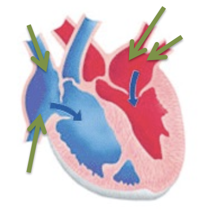<p>is this systolic or diastolic?</p>