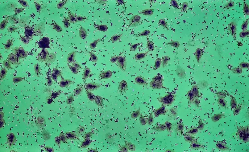 <p><span data-name="microscope" data-type="emoji">🔬</span><span data-name="petri_dish" data-type="emoji">🧫</span><strong><span> </span>Na podstawie zdjęcia preparatu:</strong></p><p></p><ul><li><p><span data-name="book" data-type="emoji">📖</span><span> </span>rozpoznaj gatunek pasożyta;</p></li></ul><p></p><ul><li><p><span data-name="recycle" data-type="emoji">♻</span><span> </span>rozpoznaj wszystkie formy rozwojowe;</p></li></ul><p></p><ul><li><p><span data-name="microbe" data-type="emoji">🦠</span><span> </span>wskaż organelle i cechy charakterystyczne dla danego gatunku;</p></li></ul><p></p><ul><li><p><span data-name="mask" data-type="emoji">😷</span><span> </span>nazwij chorobę, którą pasożyt wywołuje.</p></li></ul><p></p>