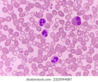 <p>What WBC is this?</p>