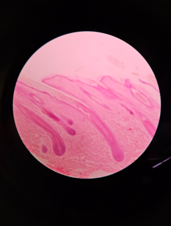 <p>follicle and hair bulb </p><p></p><p></p>