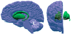 <p>group of interconnected structures that curve in a C shape around the thalamus that control planning and initiation of voluntary, smooth movement</p>