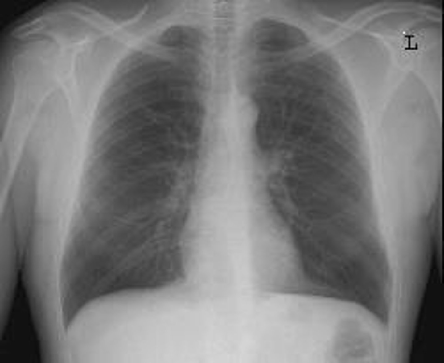 <p>Thymus, trachea, esophagus, lymph nodes, thoracic duct, heart, and great vessels.</p>