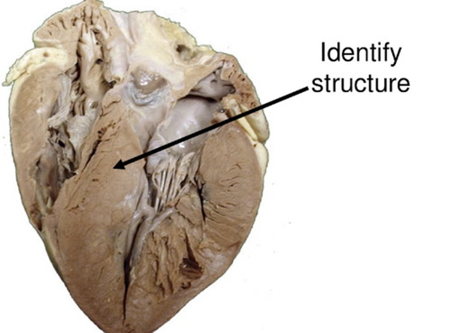 <p>portion. What is this portion in deep? DH</p>