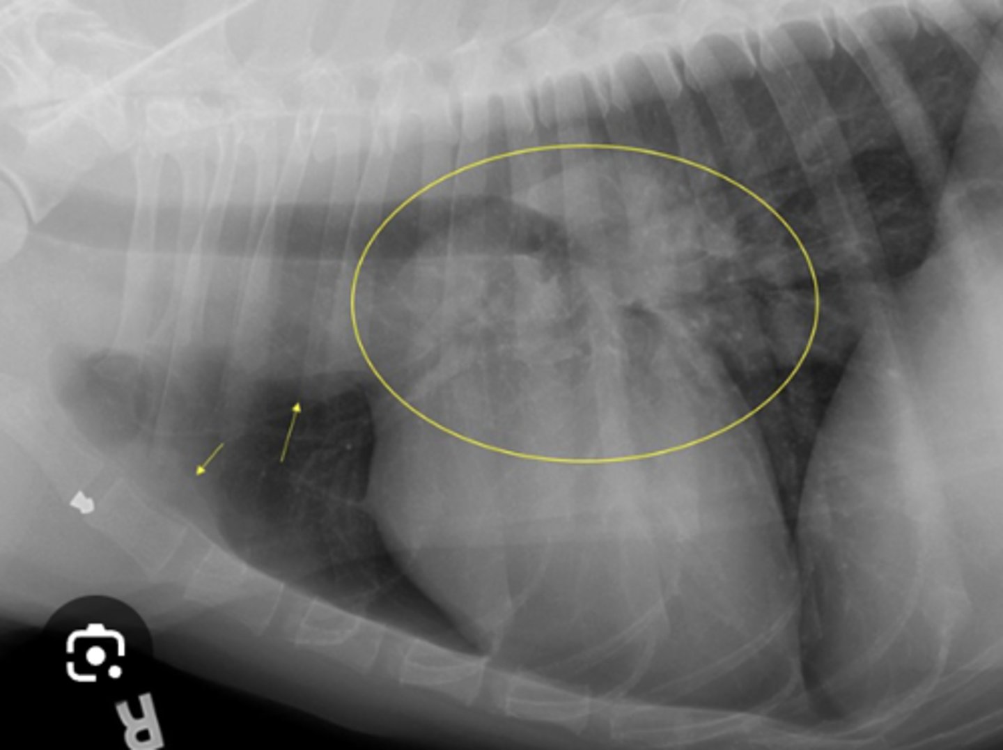 <p>What lymph node is this?</p>