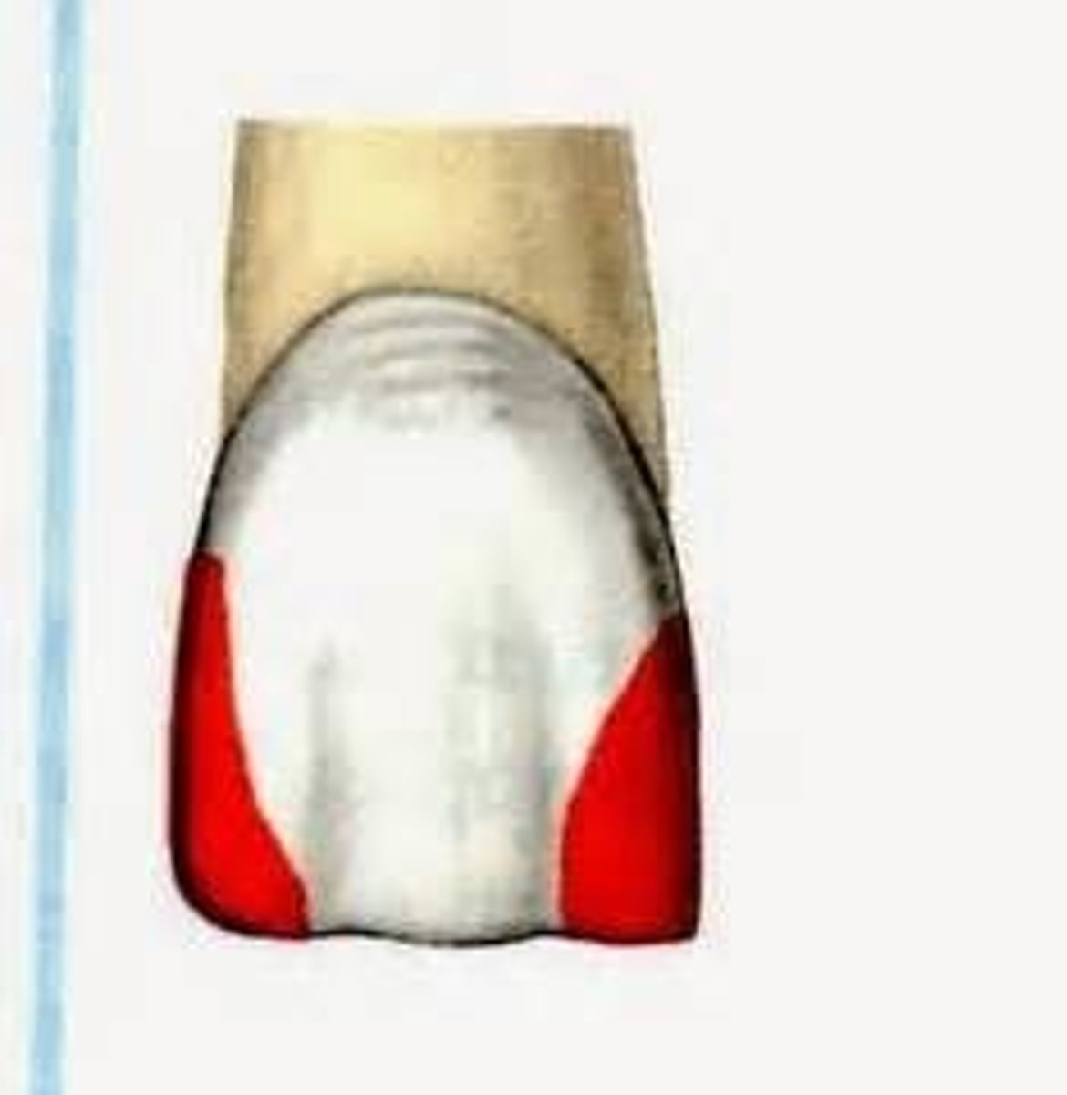 <p>proximal and incisal line angle, anterior</p>