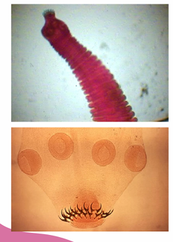 <p>General characteristics of <em>Taenia solium</em></p>