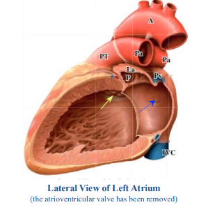 <p>-internal surface of left atrium entirely smooth except for the left auricle</p><p>-four pulmonary veins open into the left atrium</p><p>-depression seen in interatrial septum indicating the other side of the fossa ovalis (blue arrow)</p><p>-semilunar aortic valve (yellow arrow) has three cusps</p>