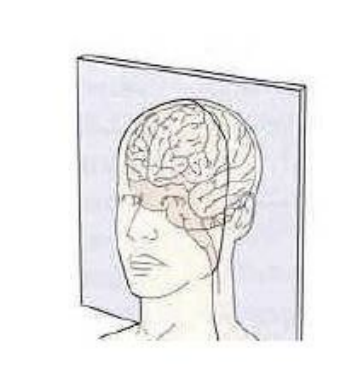 what type of slice is this