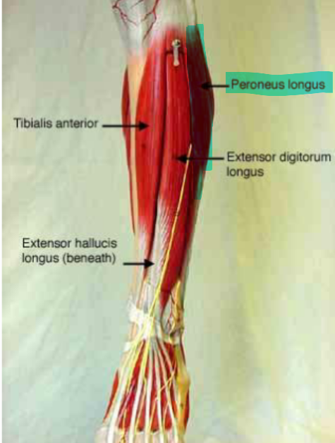 <p>Fibularis/Peroneus Longus</p>