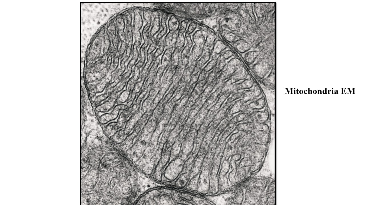 <p>Mitochondria – EM</p>