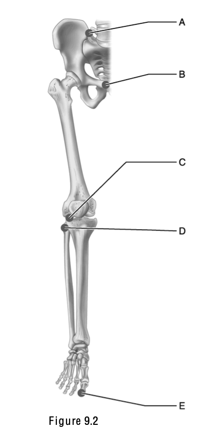 <p>This is a cartilaginous, amphiarthrotic, symphysis type of joint</p>