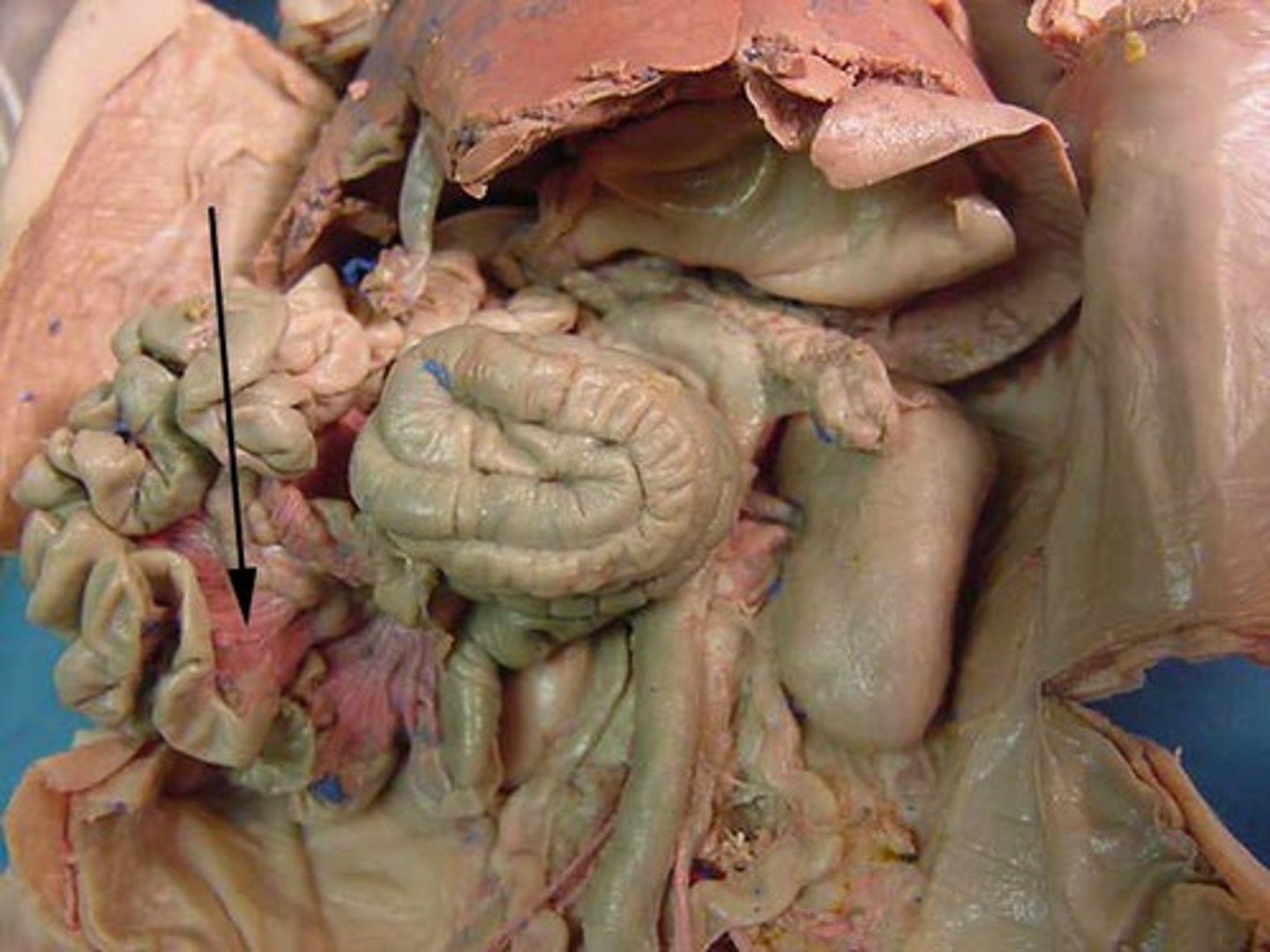 <p>Dual-layers of peritoneum that extend from the abdominal wall and attach the small intestines and other abdominal organs posteriorly to the wall. They are stringy connective tissue, and can be easily probed or cut away to isolate the intestines.</p>