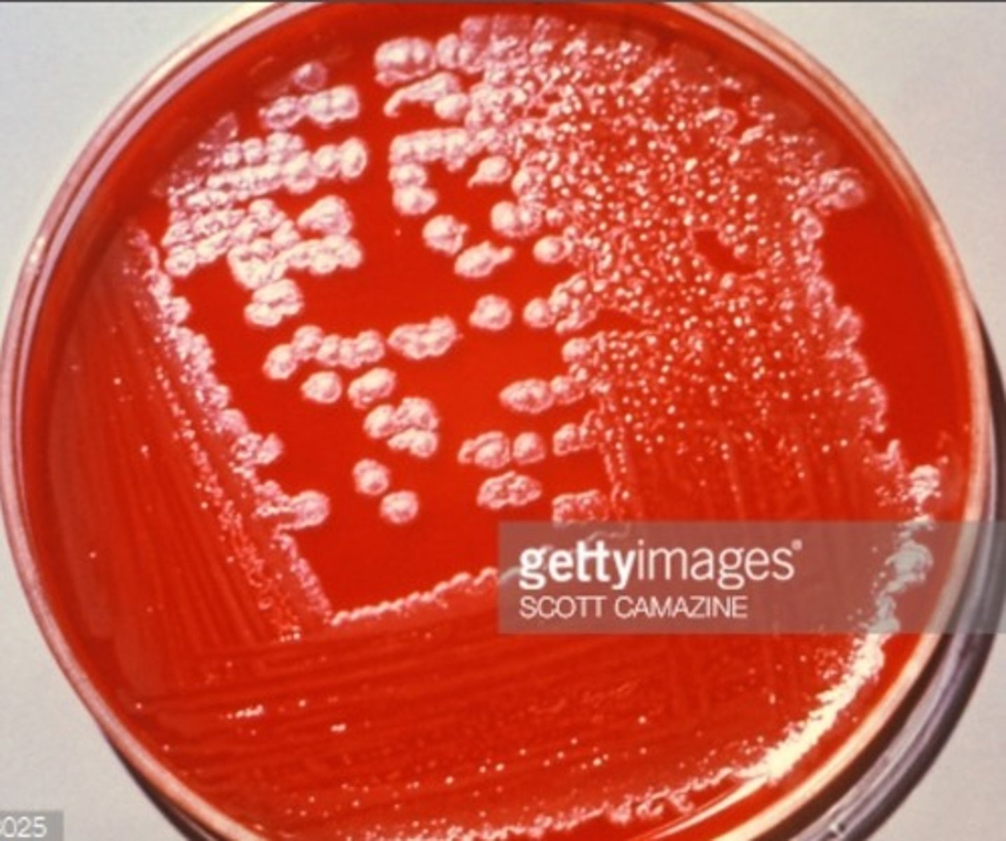 <p>Caused by bacterium, Bacillus anthracis.</p><p>It is spread by contact with spores of bacteria which are often from infectious animal products.</p><p>Transmission is by breathing, eating or contact through broken skin.</p>
